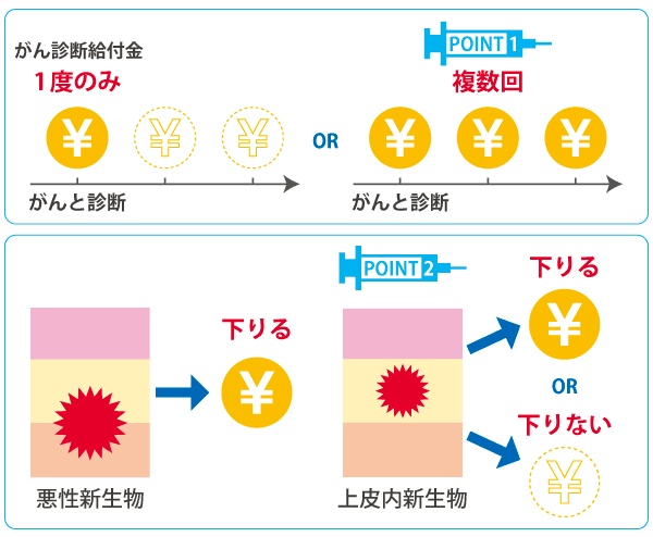 がん保険の選び方のポイント